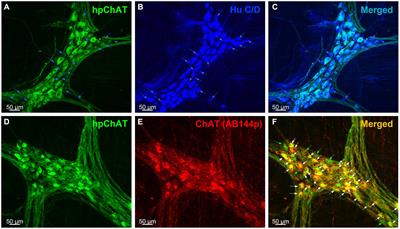 New insight on the enteric cholinergic innervation of the pig colon by central and peripheral nervous systems: reduction by repeated loperamide administration